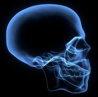 Как проводится рентген черепа?