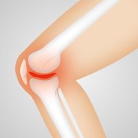 Показания к МРТ коленных суставов