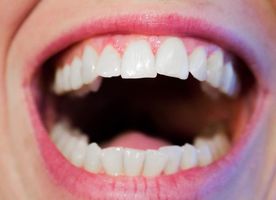 Как проводят КТ зубов