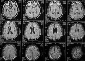Как проводится МРТ головного мозга